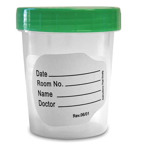 Amsure Urine Specimen Container