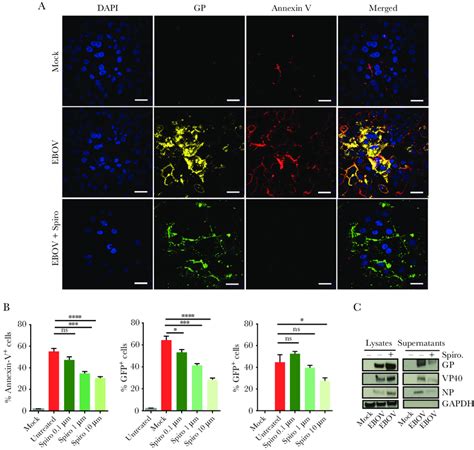 Blocking Vesicle Trafficking To The Plasma Membrane Reduces Ebola Virus