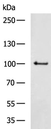 Pms Anti Pms Rabbit Polyclonal Antibody