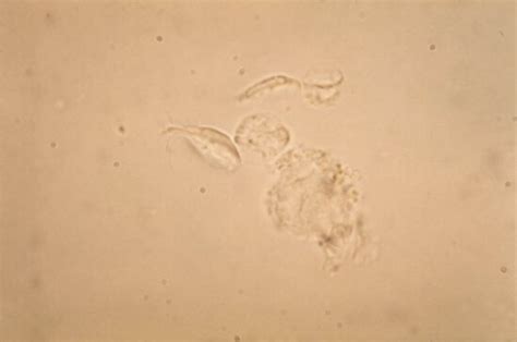 Free Picture Giardia Lamblia Parasites Immunofluorescence Test Giardiasis Cells