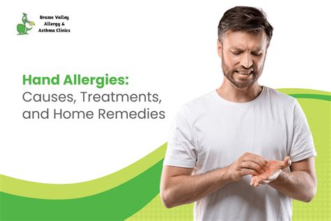 Hand Allergies: Causes, Treatments, and Home Remedies