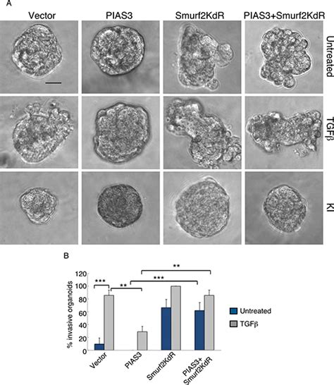 The PIAS3-Smurf2 sumoylation pathway suppresses breast cancer organoid ... 
