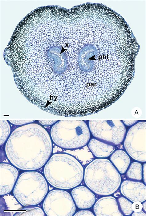 Transverse Sections Of The Petiole Of A Specimen Of The Asplenium