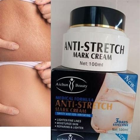 Buy Aichun Beauty Anti Stretch Marks Cream In Pakistan Tradecenter Pk