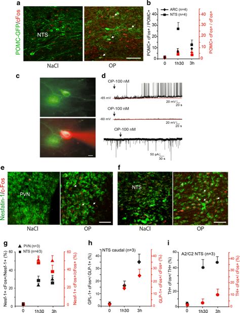 Op Activates Anorexigenic Pathways A Representative Photomicrographs