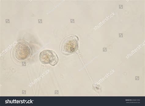 Vorticella Under Microscope View Stock Photo 636821050 | Shutterstock