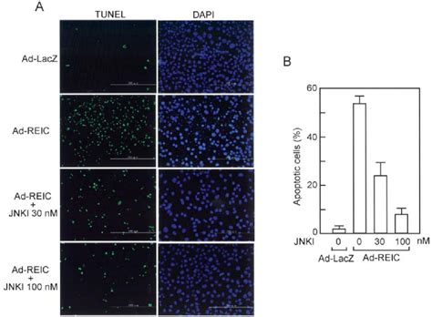 Figure From Heat Shock Proteins Play A Crucial Role In Tumor Specific