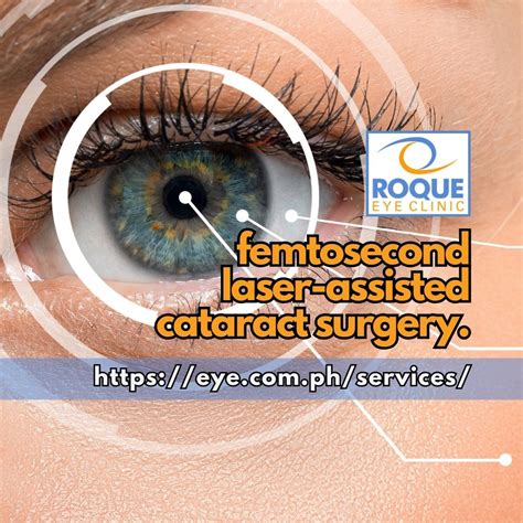 Phacoemulsification The Modern Approach To Cataract Surgery Roque