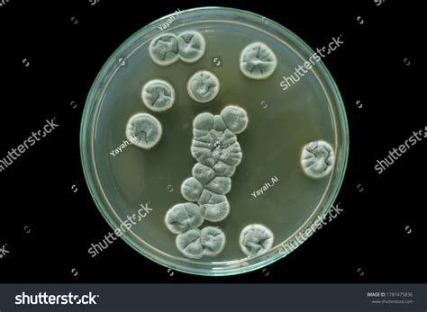 Culture Penicillium Spp Fungus On Sabouraud Stock Photo