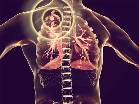 7 Most Common Lung Diseases And Their Warning Symptoms | TheHealthSite.com