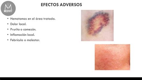 Lipopapada Enzimatica Procedimiento Tipos Cuidados PPT