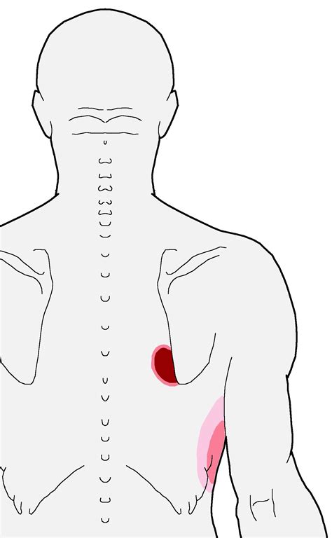 Nagging Pain Inside The Bottom Of The Shoulder Blade Integrative Works