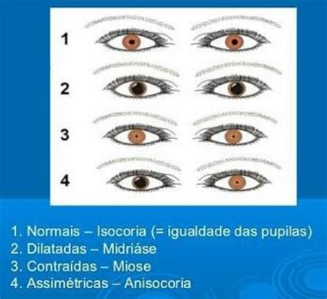 Análise de pupilas Anamnese e exame fisico Processos de Enfermagem