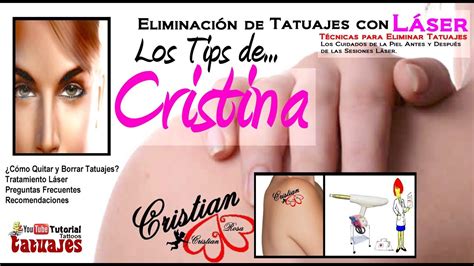 Borrar y Eliminar un Tatuaje con Láser Quitar un Tatuaje Borrado de