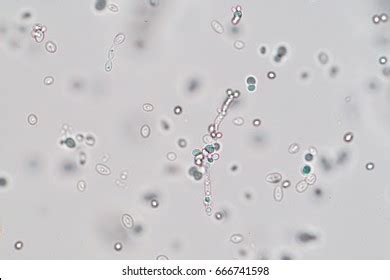 Yeast Cells Under Microscope X