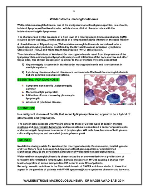 Waldenstroms Macroglobulinemia DR MAGDI SASI PDF