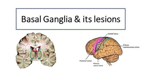 Basal Ganglia A Logical Way To Remember The Pathways And Lesions