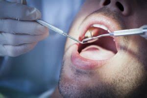 Jacksonville Dental Nerve Injury Attorneys Jacksonville Injury Attorneys