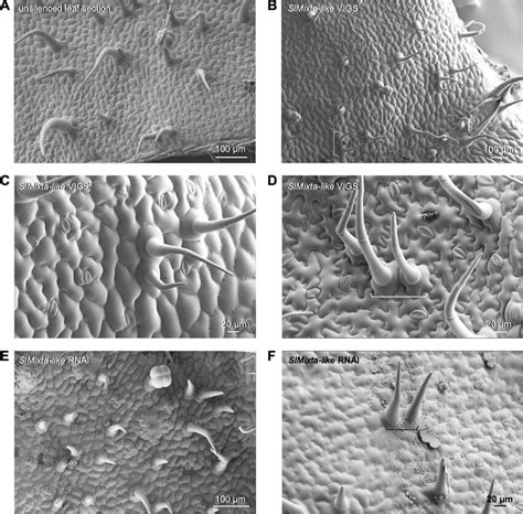 Virus Induced Gene Silencing Of SlMixta Like In Tomato Leaves A SEM