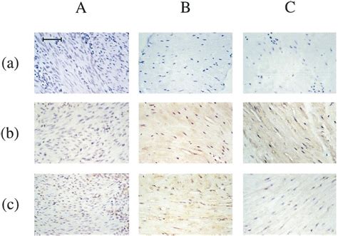 Localization Of Tgf Receptors In Uterine Smooth Muscle Cells In The