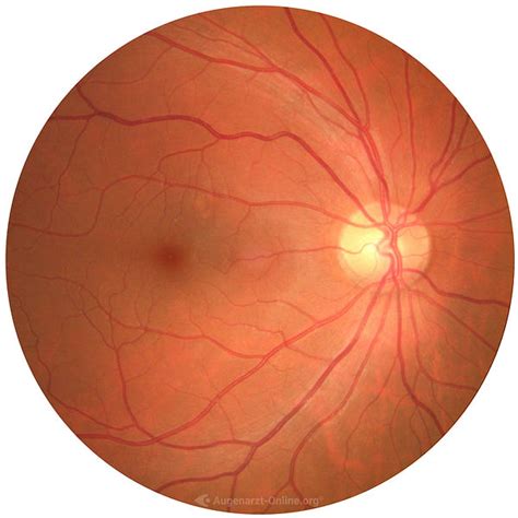 Beurteilung Netzhaut Fundus Trainer