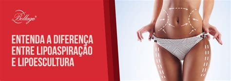 Entenda A Diferen A Entre Lipoaspira O E Lipoescultura De Uma Vez Por