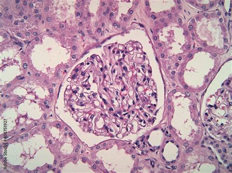 Kidney Biopsy Showing A Normal Glomerulus Composed Of Thin Capillaries