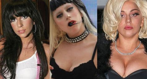 Lady Gaga Plastic Surgery Before And After Pictures 2024