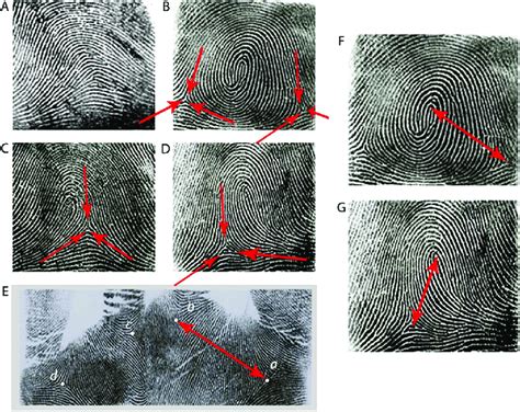 Ulnar Loop Vs Radial Loop Fingerprint