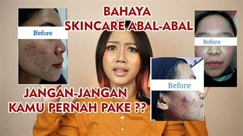 Perbedaan Skincare Sehat Dan Skincare Abal Abal Youtube