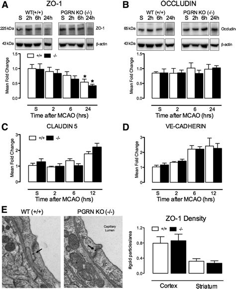 Progranulin Deficiency Promotes Post Ischemic Bloodbrain Barrier