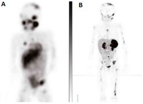 onco  open access journal  mdpi