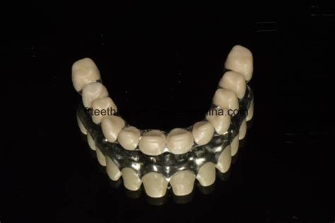 Full Arch Zirconia Screwed Implant Bridge China Dental Implant And