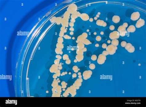 Pile Petri Dish With Growing Cultures Of Microorganisms In Doctor Hand