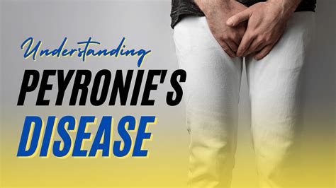 peyronies disease symptoms  treatment