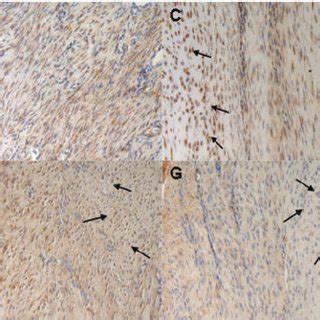 Photographs Showing The Immunohistochemical Staining Of Collagen Type