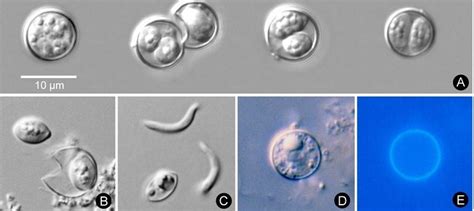 Cyclospora: What Is The Parasite Infecting Some Texans, And How Does It ...