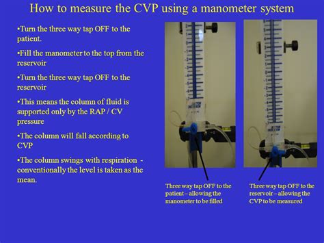 Ppt Central Venous Line Cvl And Central Venous Pressure Off