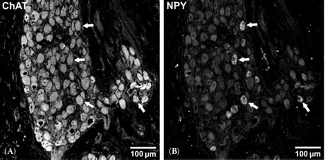 Immunohistochemical Characterisation Of Neurons In The Mandibular