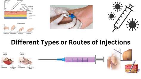 Types Of Injections Routes Of Injections Intra Muscular Im Intra Venous Iv Id Sc Youtube