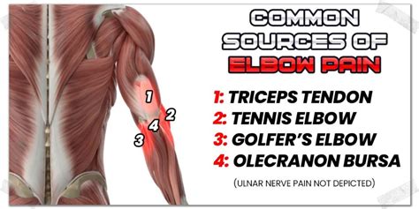 elbow pain explained  janna altieri blog