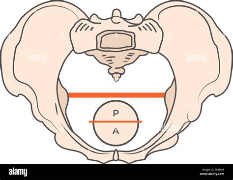 Gynecoid Pelvis Shape w Round or Circular shape Stock Vector Image & Art - Alamy