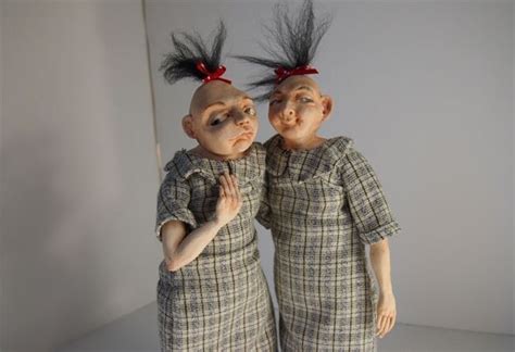 Pip And Flip The Circus Sisters Whose Ugliness Made A Lot Of Money 7