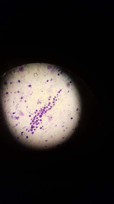 Sputum gram stain. : r/underthemicroscope