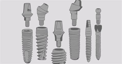 What Makes Each Dental Implant System Unique Brighton Implant Clinic