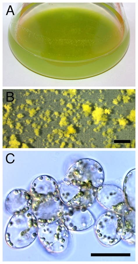 Plant Cell Suspension Culture Protocol / Essay on Plant Tissue Culture ...