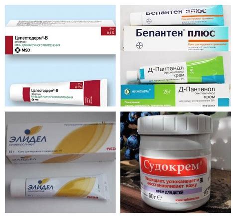 Обзор кремов от дерматита для детей: чем мазать ребенка