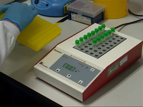 Array Comparative Genomic Hybridization Array CGH For Detection Of