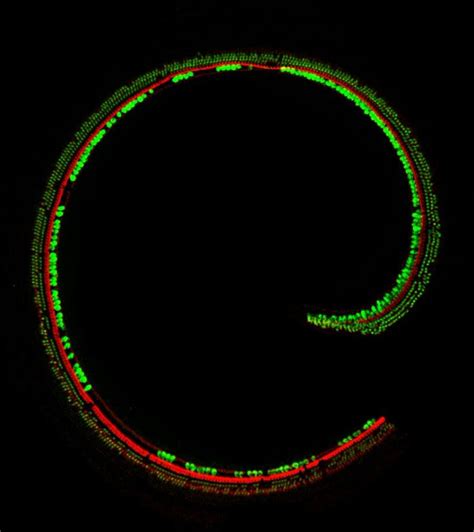 Gene Therapy Restores Hearing In Deaf Mice