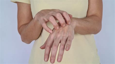 Signs Of Psoriatic Arthritis On Your Hands, Fingers, And Nails ...